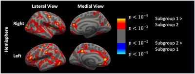 Widespread cortical thinning, excessive glutamate and impaired linguistic functioning in schizophrenia: A cluster analytic approach